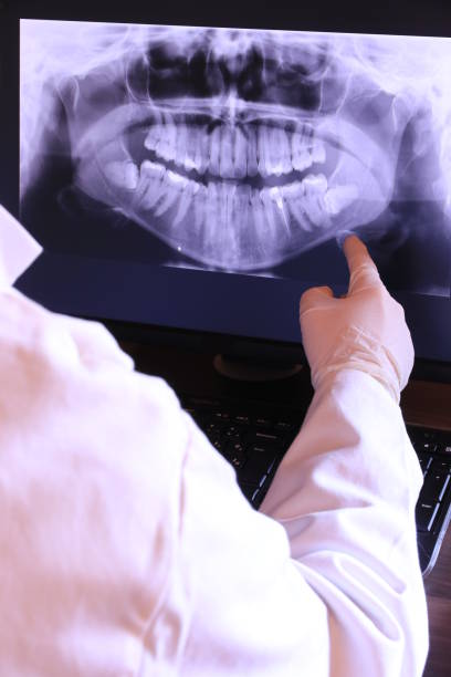 Best Emergency Root Canal Treatment in Little Elm, TX